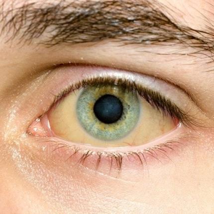 κίτρινα μάτια