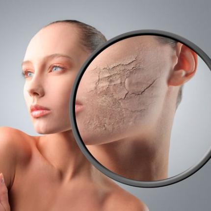 ξηροδερμια