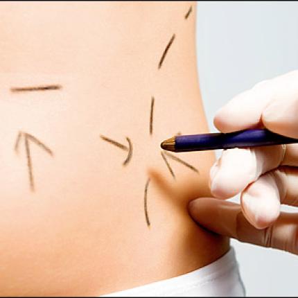 Η "έξυπνη" λιποαναρρόφηση ... κάνει θαύματα