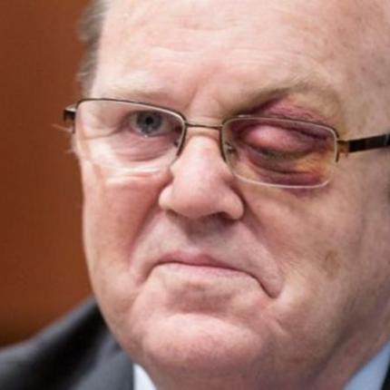 Με μαυρισμένο μάτι στο Eurogroup ο Ιρλανδός υπουργός Οικονομικών