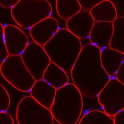 Δημιουργήθηκε στο εργαστήριο ανθρώπινος σκελετικός μυς που συσπάται σαν τον φυσικό