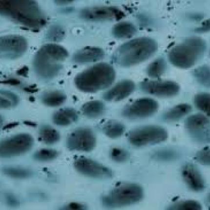 "Χάρτης" επικίνδυνων μικροβίων από το υπουργείο Υγείας