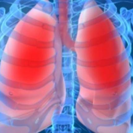 Τα "ένοχα" σημάδια ότι τα πνευμόνια σας γεμίζουν με υγρό