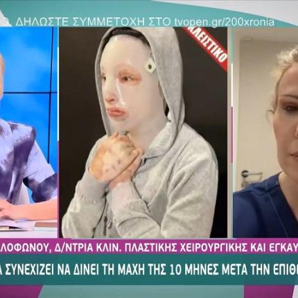 επιθεση με βιτριόλι