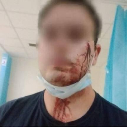 τραυματίας αστυνομικός