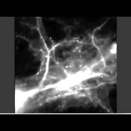 Επιστήμονες ...βιντεοσκόπησαν πως αποτυπώνεται μια ανάμνηση στον εγκέφαλο