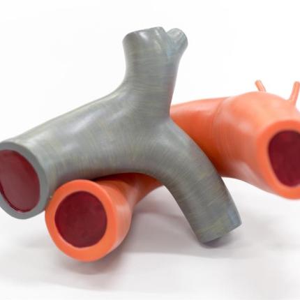 ηλεκτρονικά αιμοφόρα αγγεία