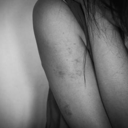 Βία γυναικων