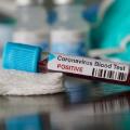 κωρονοϊός-τεστ