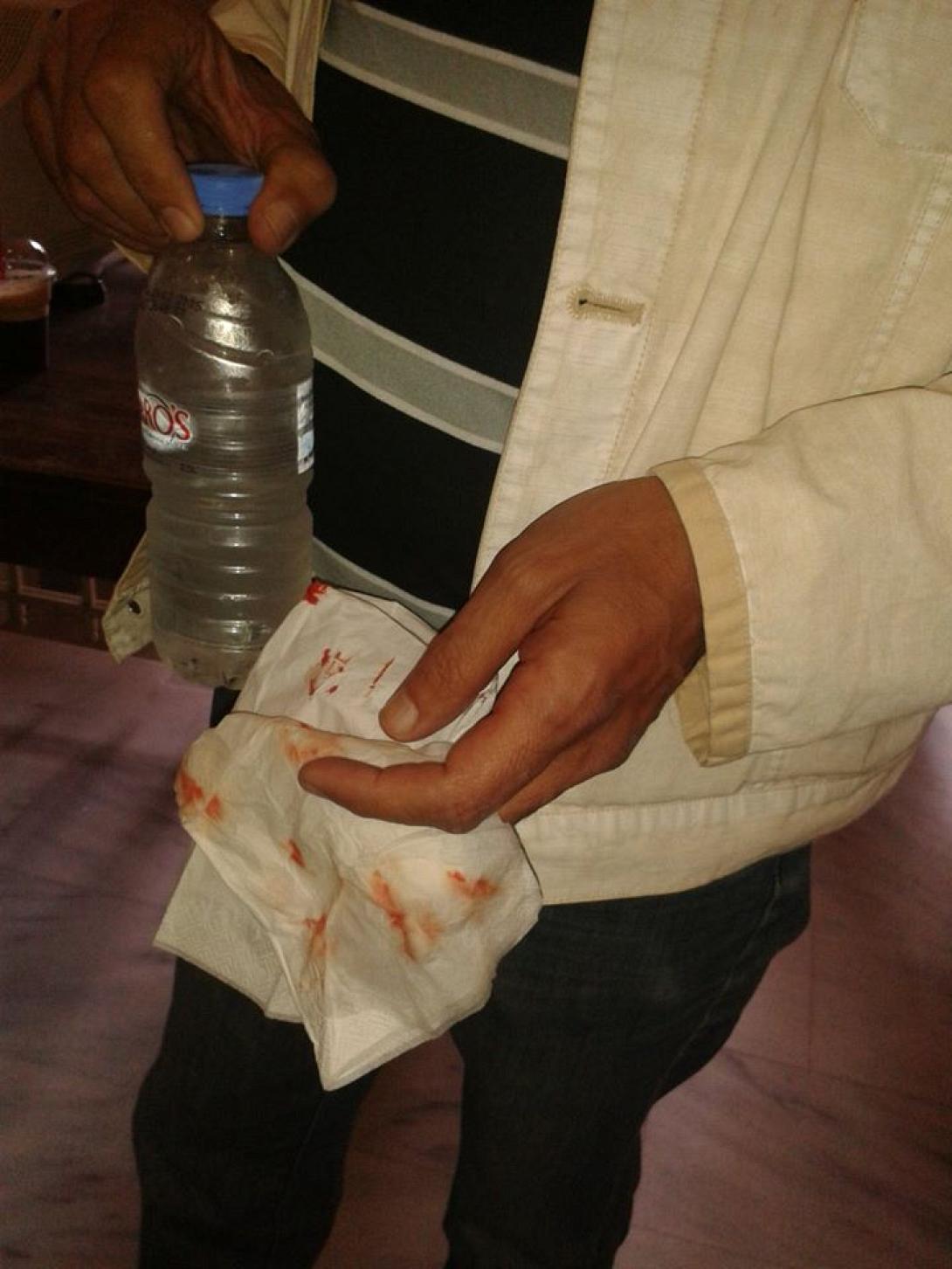 Η Δημοτική Παράταξη "Άμεση Δημοκρατία" καταδικάζει επεισόδια στο Ειρηνοδικείο Ηρακλείου