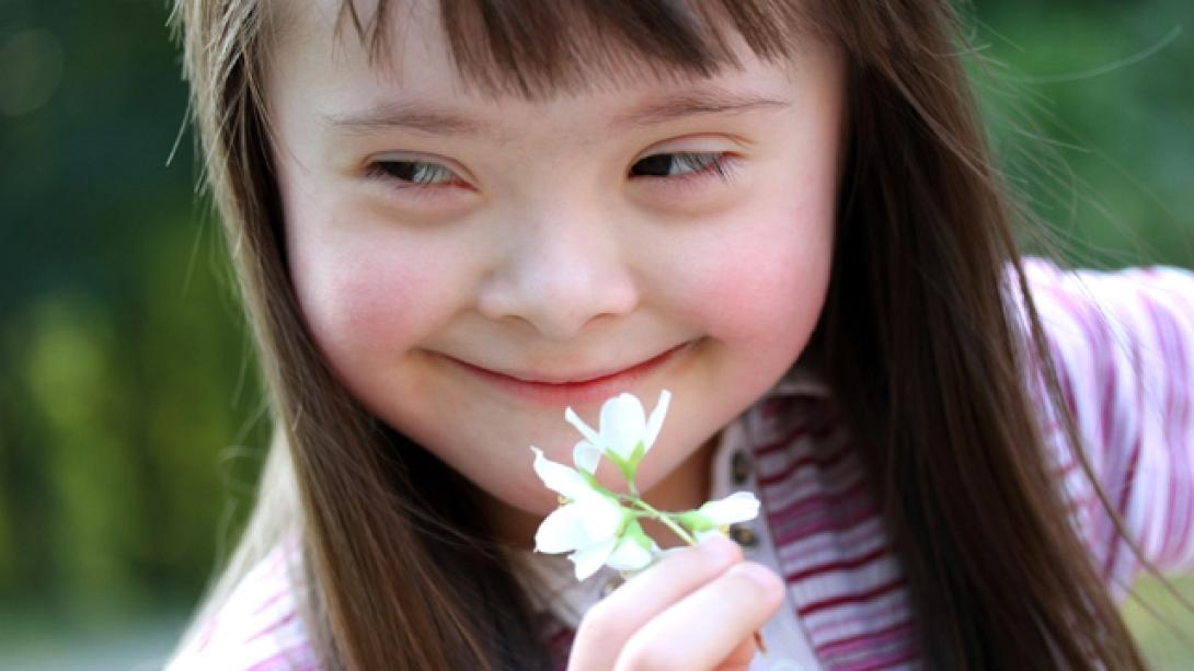 down-syndrome.jpg