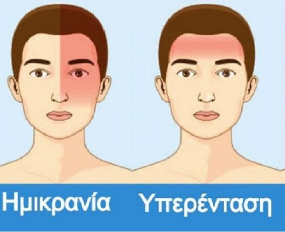 πονοκέφαλος