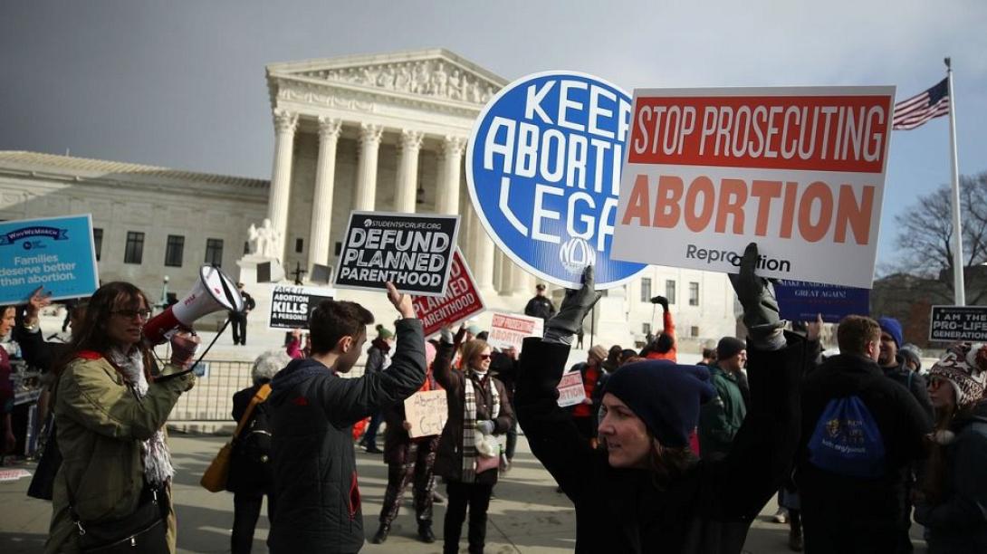 άμβλωση ΗΠΑ