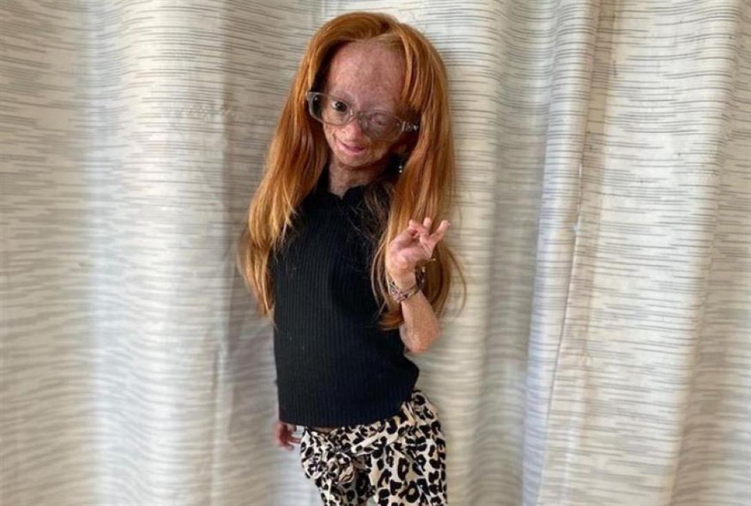 Αντάλια Ρόουζ