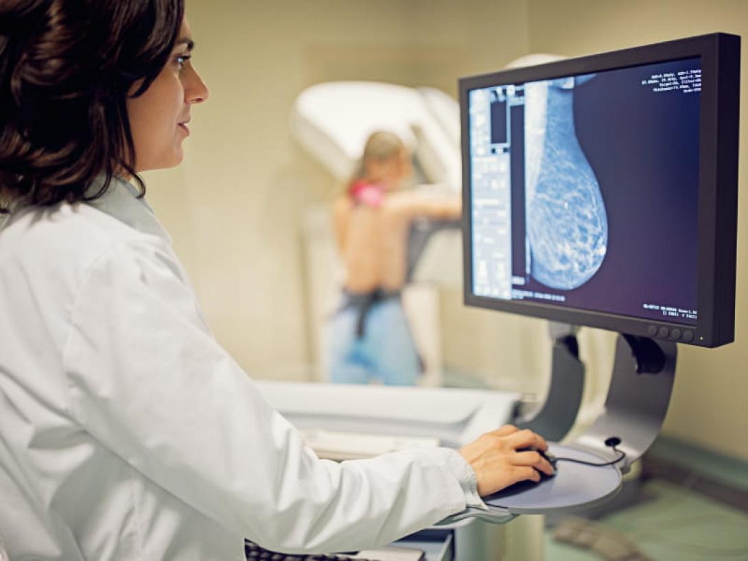 μαστογραφία