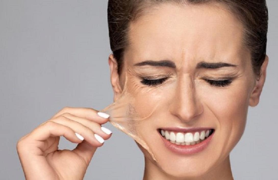 γυναίκα, επιδερμίδα, πρόωρη γήρανση, αντιγήρανση