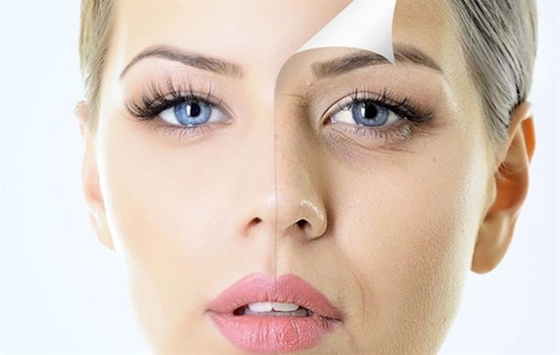 αντιγήρανση