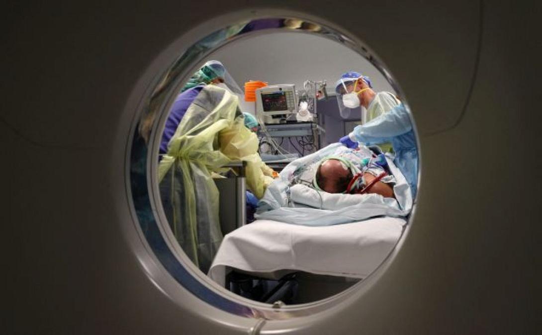 Οι αλλοιώσεις στον εγκέφαλο από long-covid 