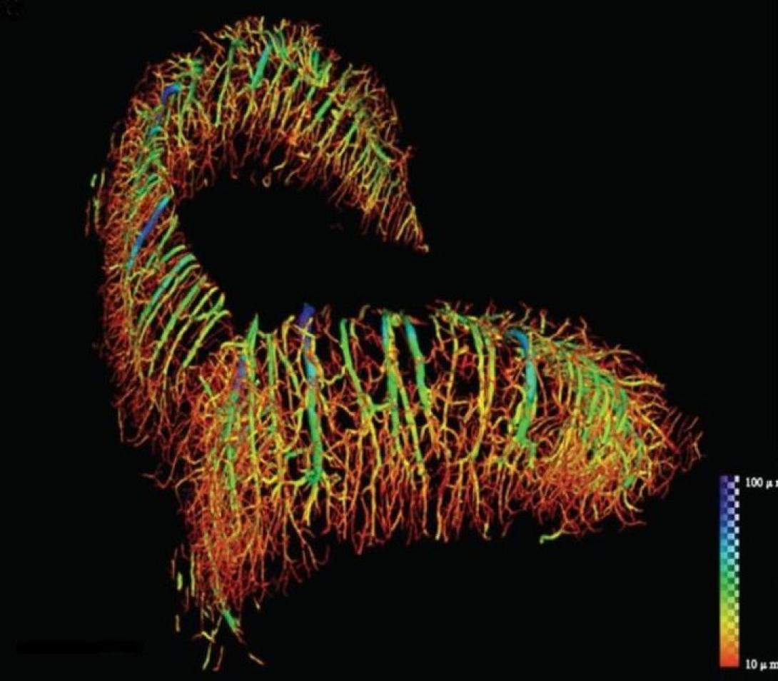 Ακτινογραφία με νέο λέιζερ μετρά το νερό στους ιστούς μας 
