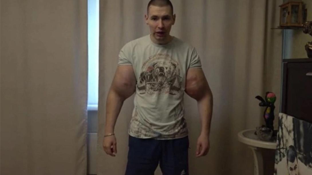 Ο Ρώσος που θέλει  να μεταμορφωθεί σε εξωγήινο 