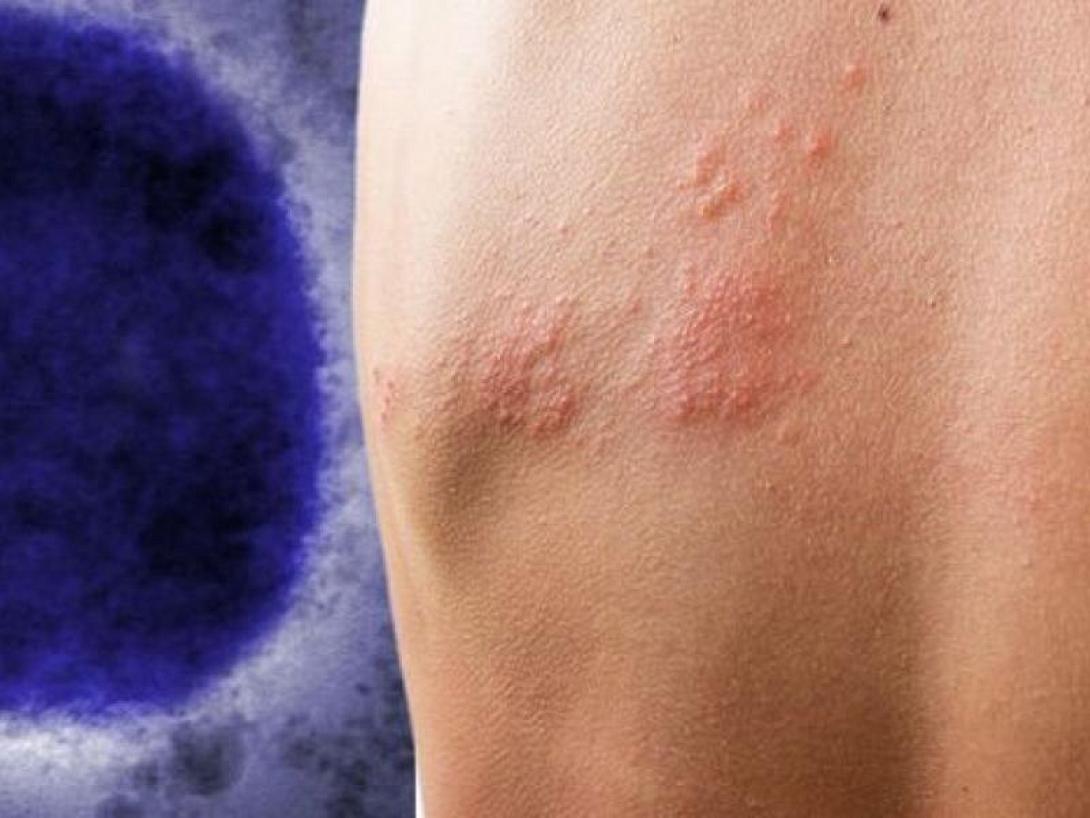 ευλογια των πιθήκων