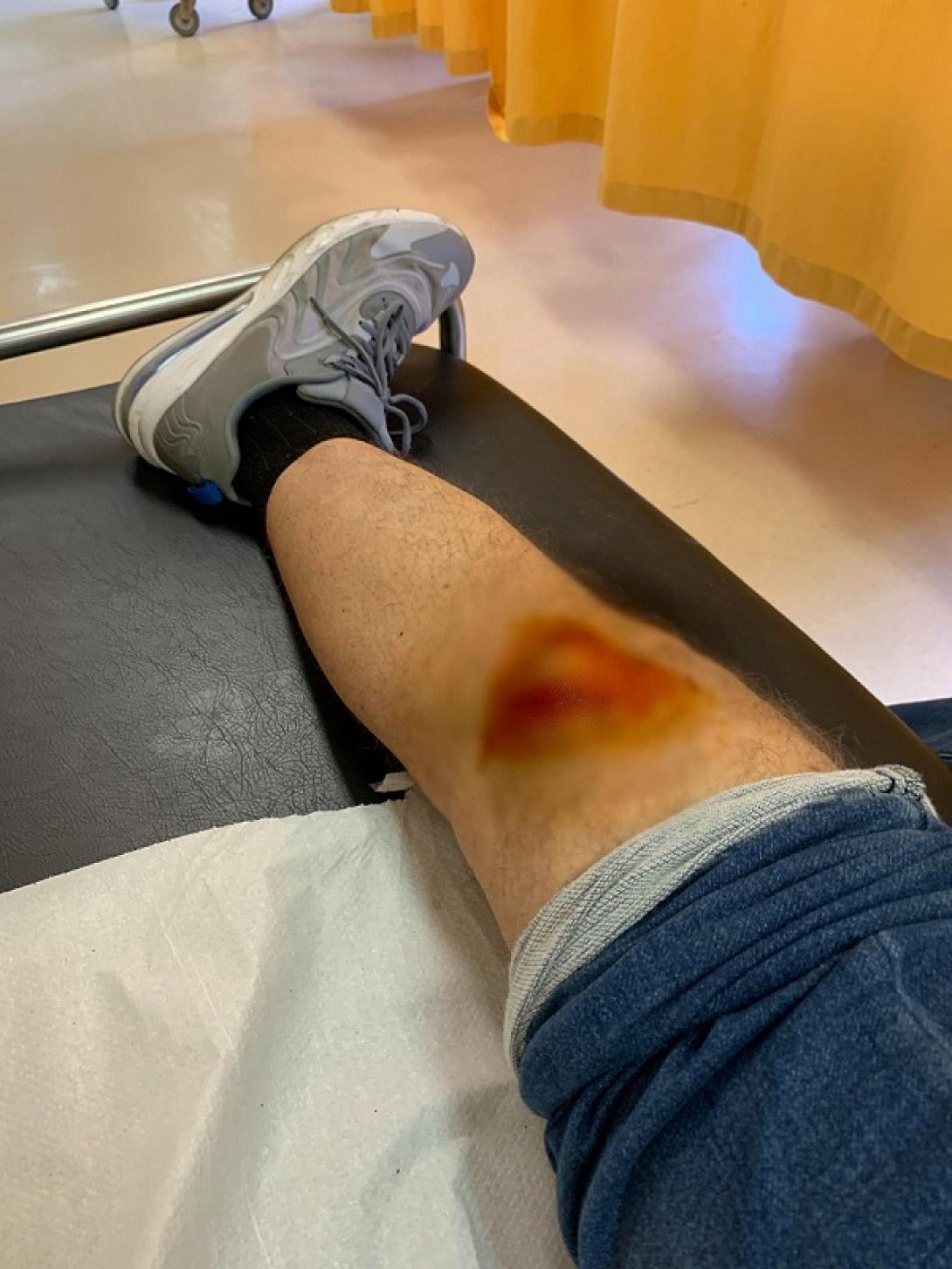 επίθεση σκύλου