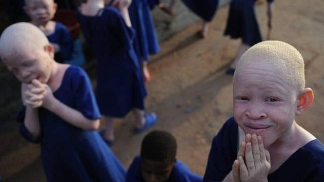 Δολοφόνησε τον Αλμπίνο αδερφό του και πούλησε τα μέλη του σώματος του