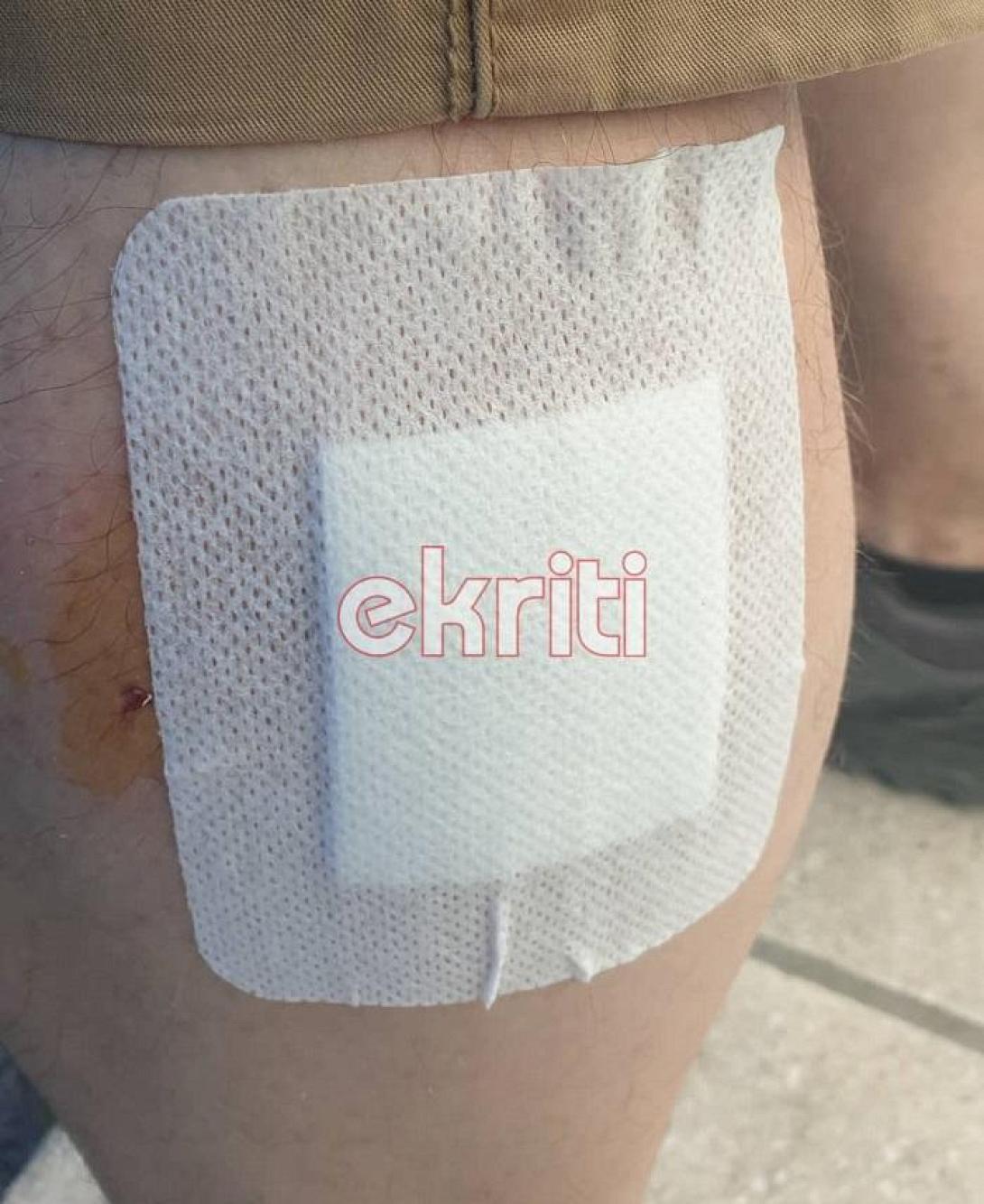 επίθεση σκύλου - νέο