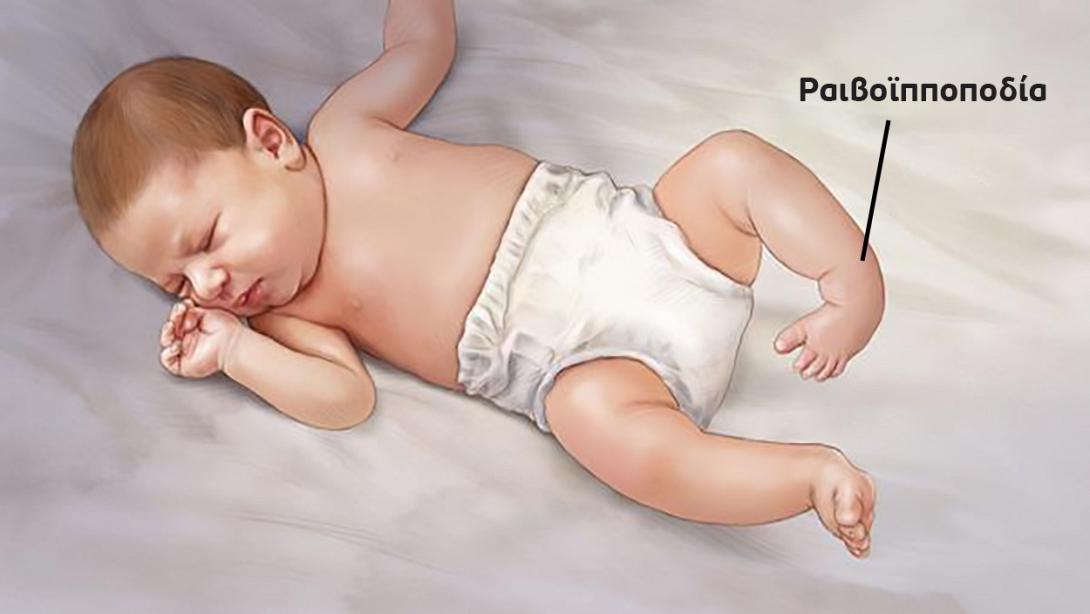 ραιβοιποποδία 