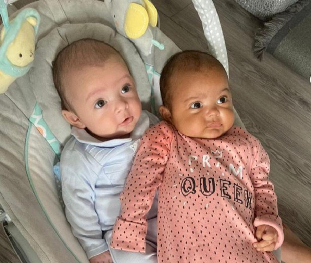 δίδυμα με διαφορετικό χρώμα δέρματος