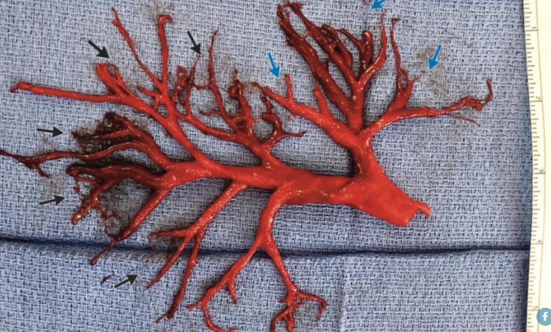 ιατρικό εύρημα