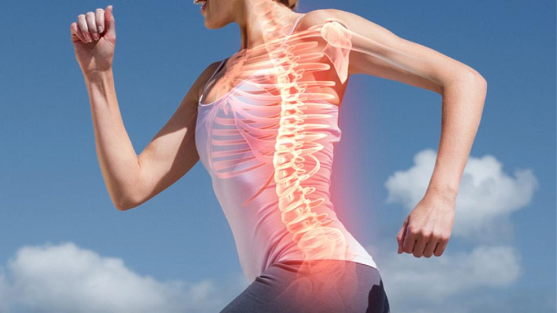 γυναίκα, οστά, οστεοπόρωση