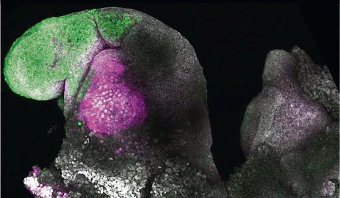 ΤΕΧΝΗΤΟ ΕΜΒΡΥΟ