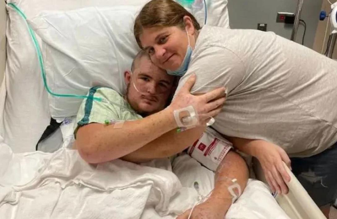 μέλισσες ΗΠΑ