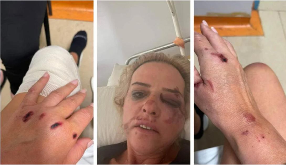 σκυλιά καλαμάτα