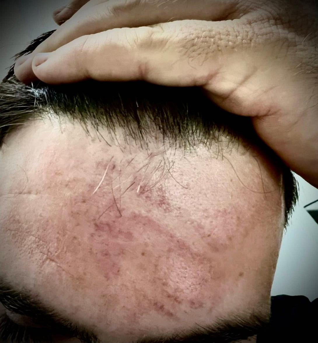 τραυματα - αστυνομικος