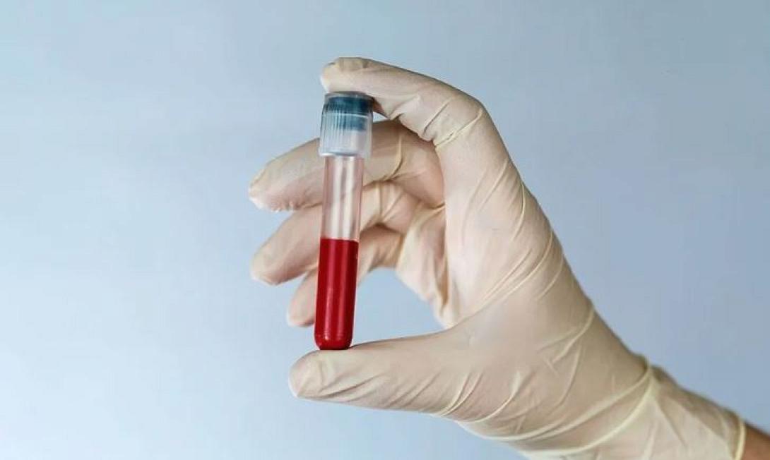 ΤΕΣΤ ΑΙΜΑΤΟΣ