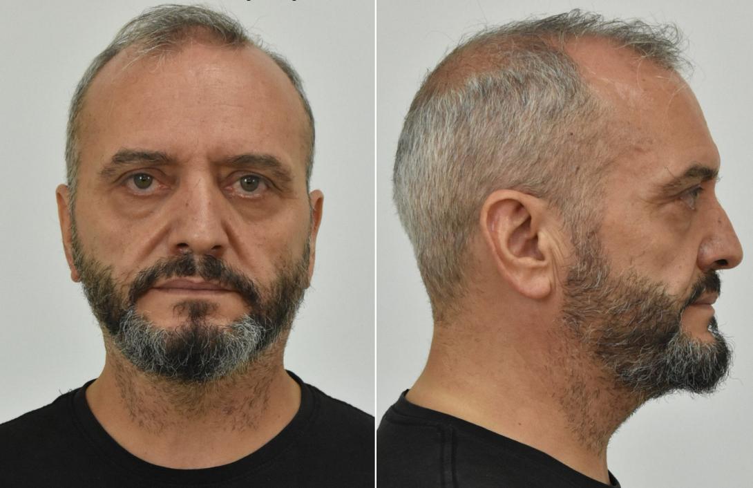 Ηλίας Μίχος