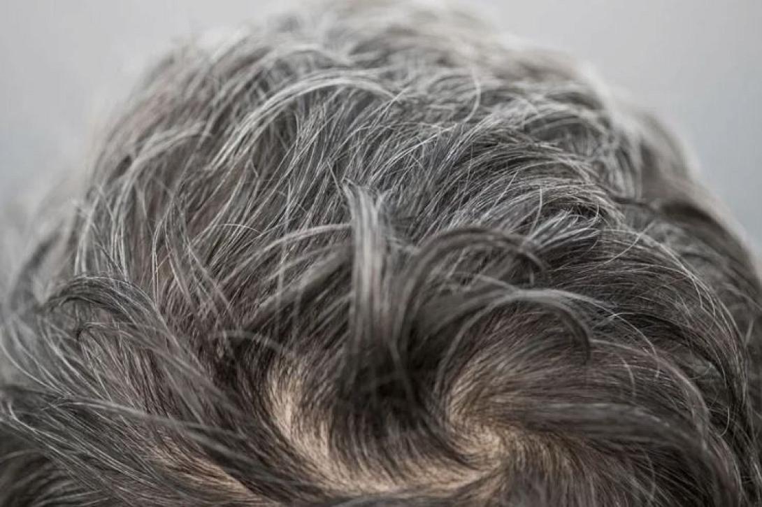 ΓΚΡΙΖΑ ΜΑΛΛΙΑ