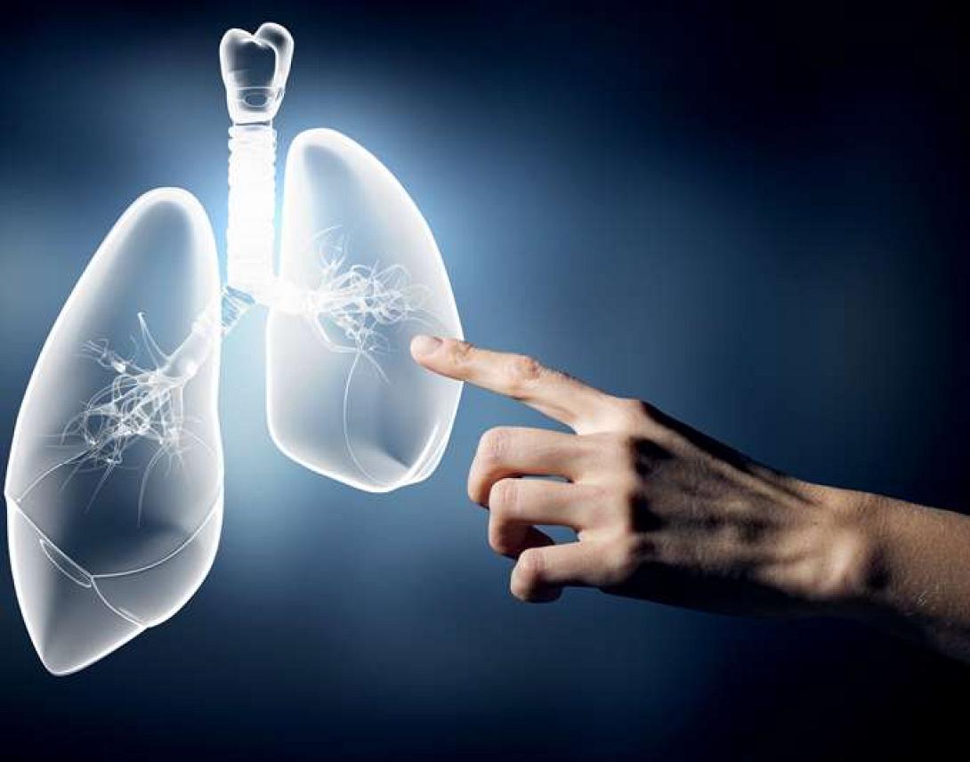 καρκίνος πνεύμονα