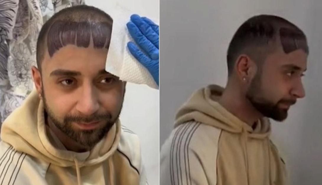 ΦΑΛΑΚΡΟΣ ΤΑΤΟΥΑΖ