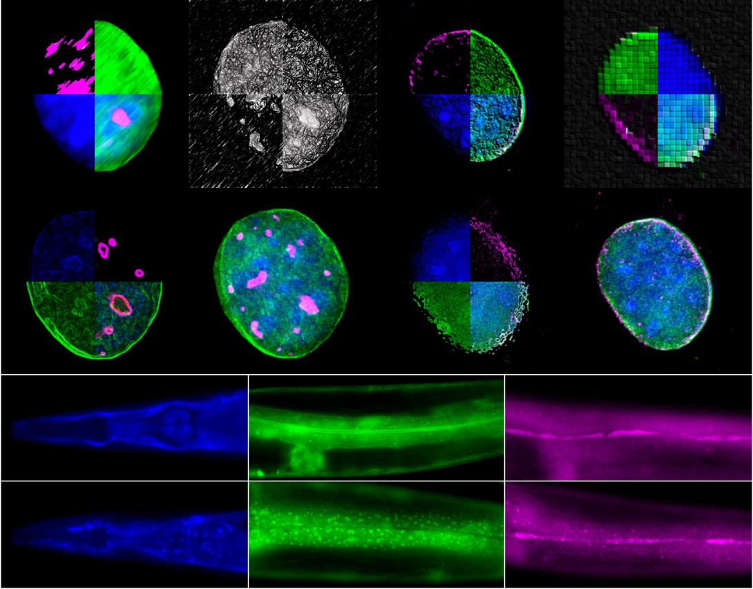 ανακαλυψη ΙΤΕ - Γηρανση