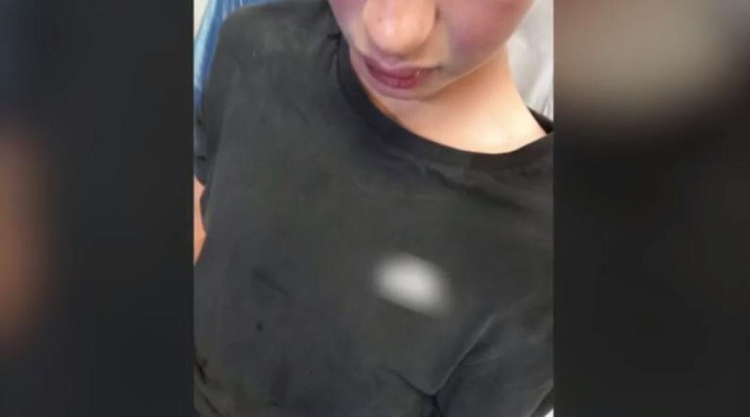 ΚΑΛΑΜΑΤΑ ΞΥΛΟΔΑΡΜΟΣ