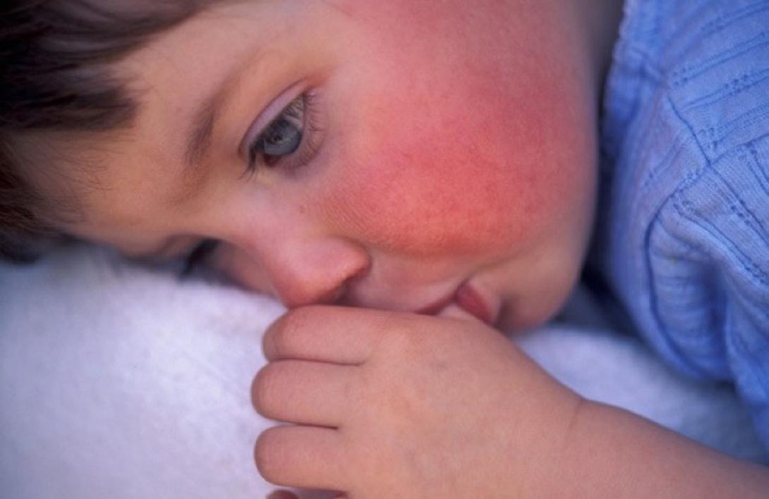 άρρωστο παιδί