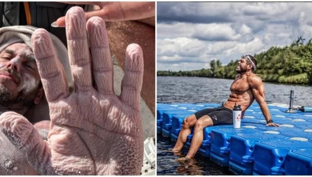 θερμοπληξία