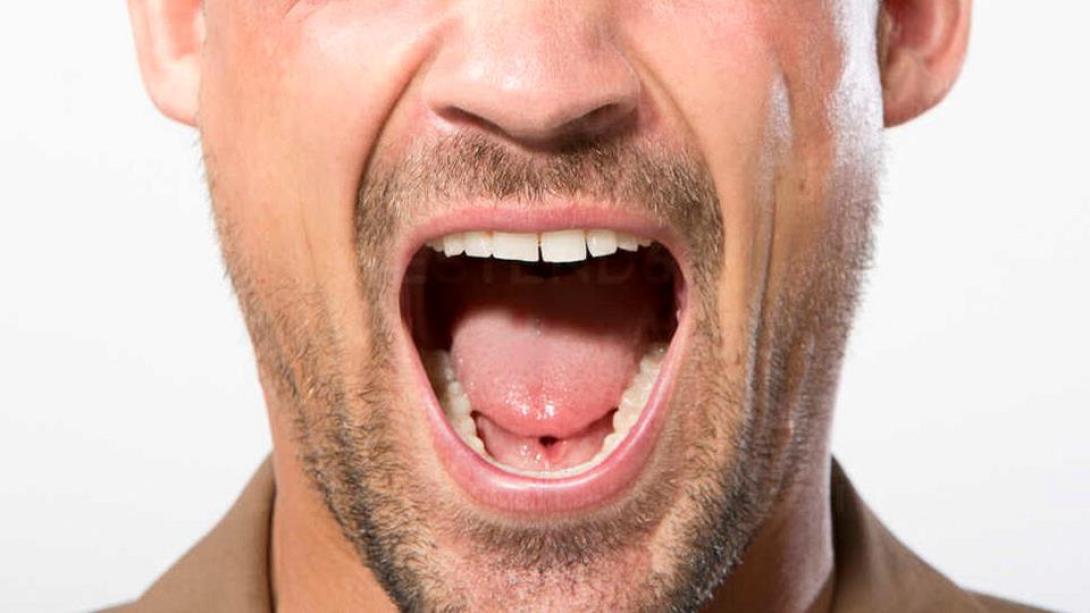 καρκίνος στόματος