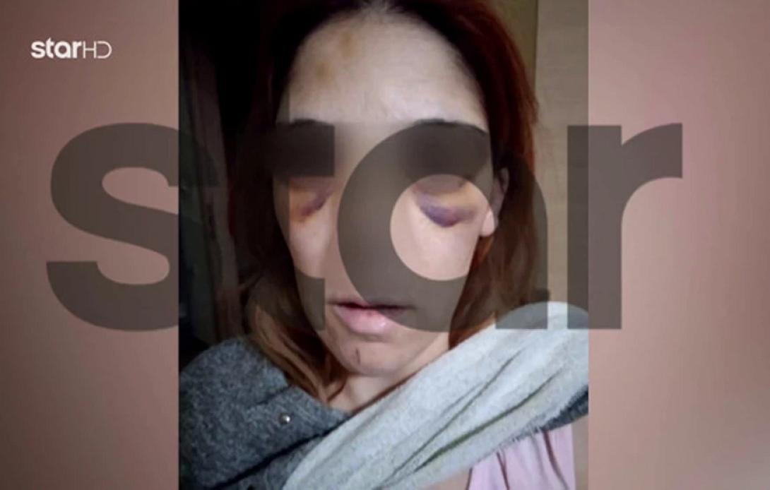 αργος κακοποιηση