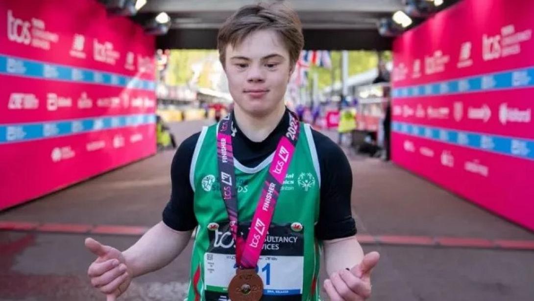 19ΧΡΟΝΟΣ σύνδρομο Down