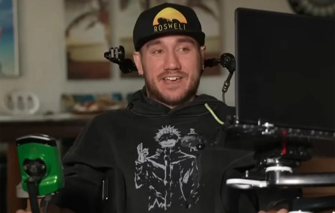 εμφυτευμα εγκεφαλος