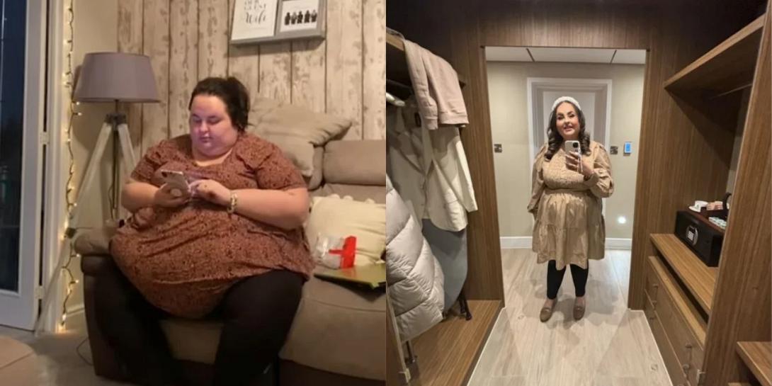 παχυσαρκία γυναίκα πριν μετά